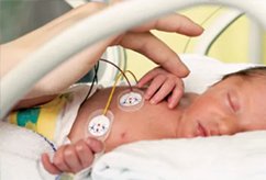 NICU